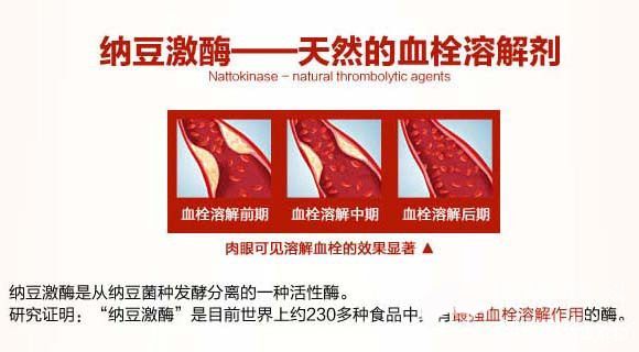 纳豆激酶